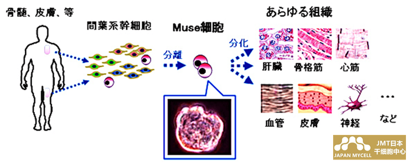 JMT日本干细胞-什么是Muse细胞？对急性心肌梗死、脑梗死、脊髓损伤、大疱性表皮松解症患者的临床试验也进行解释说明！