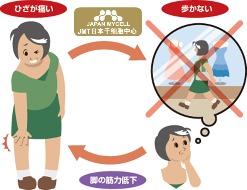 JMT日本干细胞治疗变形性膝关节-变形性膝关节疾病是什么？患病原因？怎么治疗?