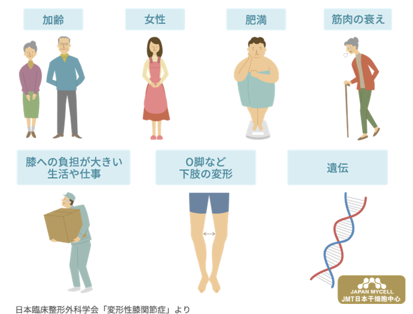 JMT日本干细胞治疗变形性膝关节-什么是变形性膝关节病？