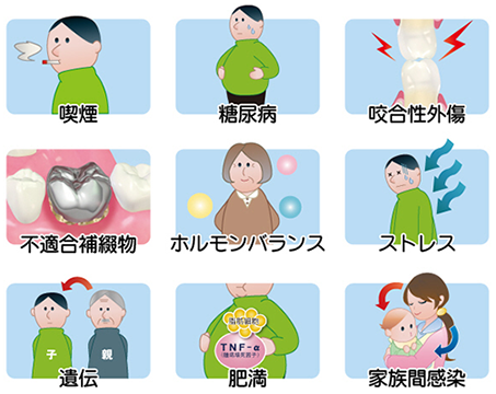 JMT日本干细胞治疗牙周病-牙周病形成的原因及症状
