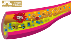 JMT日本干细胞治疗牙周病-牙周病对心脏疾病糖尿病的影响