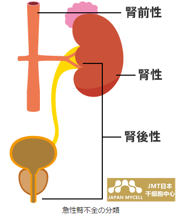 JMT日本干细胞治疗肾衰竭-肾衰竭的原因和诊断