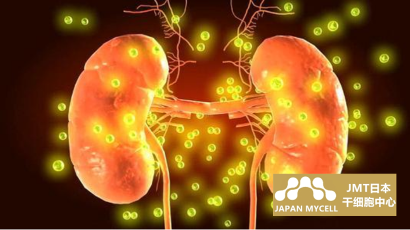 JMT日本干细胞治疗肾功能衰竭-肾功能衰竭注意事项