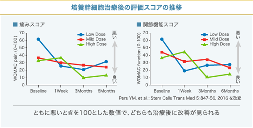 JMT日本干细胞中心-变形性关节症膝关节疾病半月板损伤关节炎的干细胞治疗效果