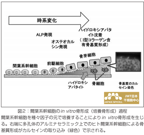 JMT日本干细胞中心-骨再生医疗②