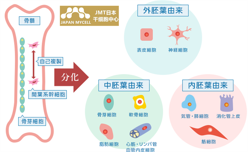 日本干细胞-脑卒中再生治疗的效果和可能性