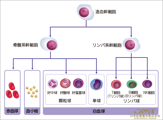 JMT日本干细胞——关于急性淋巴细胞白血病/淋巴细胞淋巴瘤的概述、症状与原因
