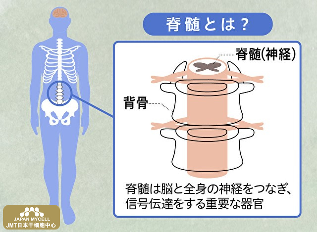 JMT日本干细胞中心-为治疗脊髓损伤带来光明，用自己的细胞进行神经再生，札幌医大的干细胞治疗④