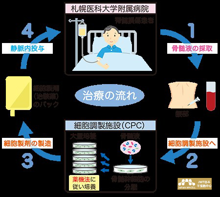 JMT日本干细胞治疗脊髓损伤-脊髓损伤的日本干细胞治疗研究进展