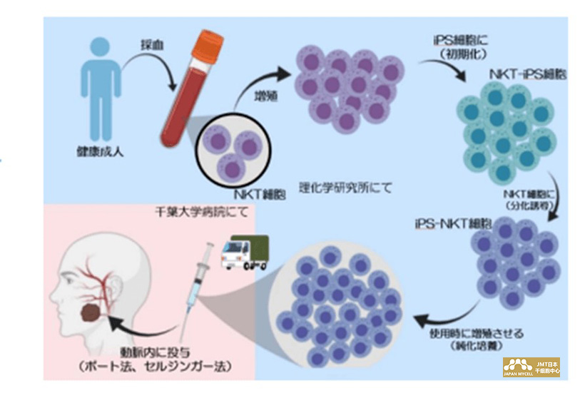 JMT日本干细胞最新资讯--IPS干细胞日本首个癌症治疗，千叶大学等进行临床试验，移植成功