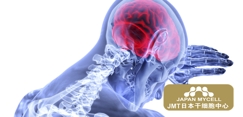 JMT日本干细胞中心-日本干细胞的常见应用