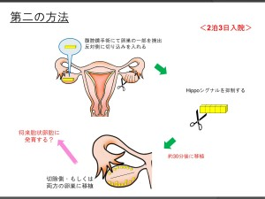 JMT日本经血干细胞-关于衰老卵巢的治疗