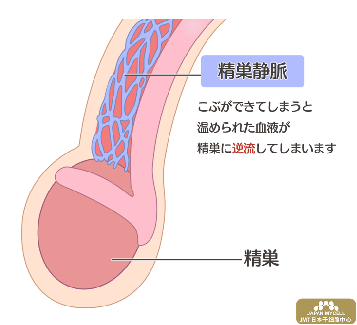 男性不孕症的原因和检查-日本干细胞治疗