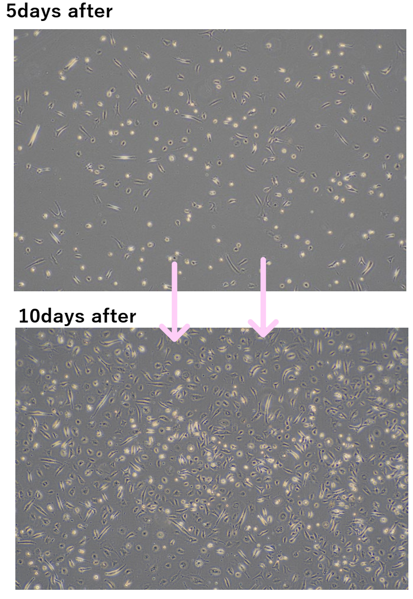 JMT日本干细胞中心-卵巢早衰更年期不孕不育的经血干细胞治疗
