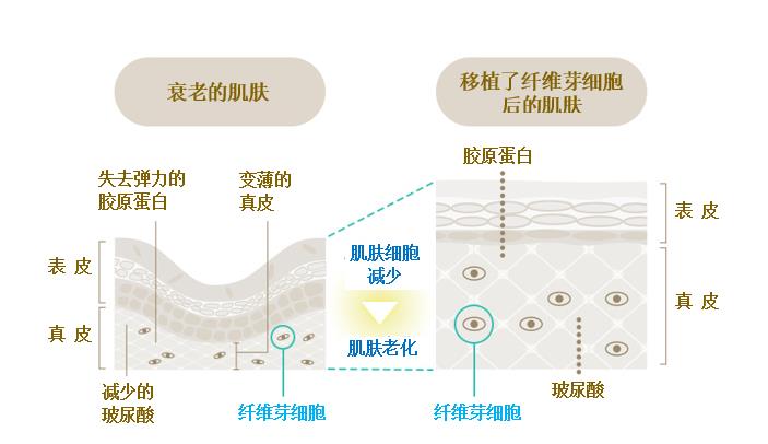 日本干细胞美容-新一代抗衰护理是什么？走近“高性能化妆品”“肌肤再生医疗”！