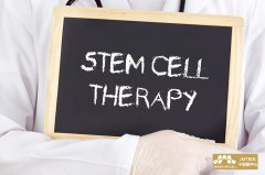 JMT日本干细胞-针对最常见的肌肤烦恼~色斑!令人可期的干细胞治疗效果