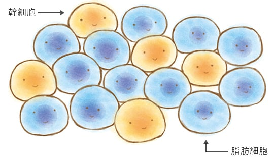 JMT日本干细胞中心-自体脂肪间叶系干细胞