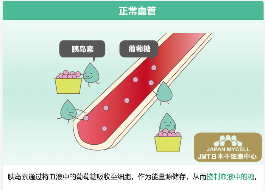 JMT日本干细胞中心-干细胞针对糖尿病·胰腺的治疗