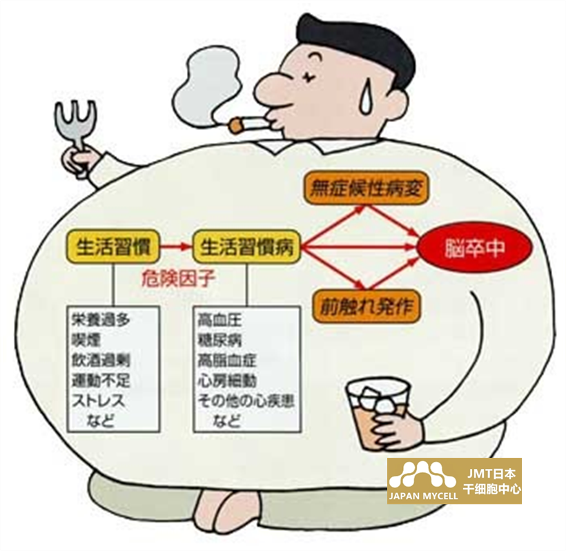JMT日本干细胞中心-脑中风脑梗脑出血易患人群及干细胞治疗