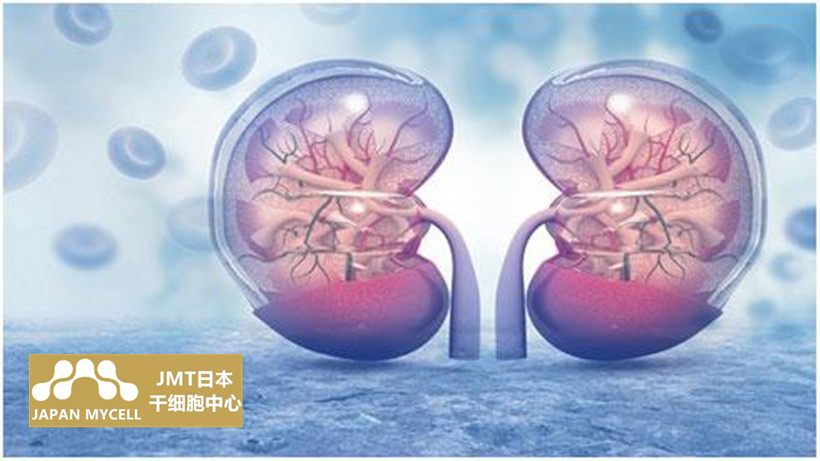 JMT日本干细胞中心-肝硬化肾衰竭的常规治疗