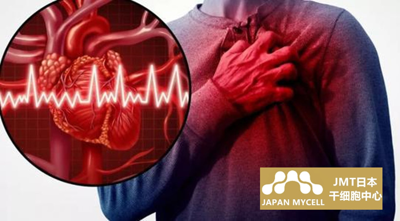 JMT日本干细胞中心-干细胞治疗心肌梗塞的细胞种类②