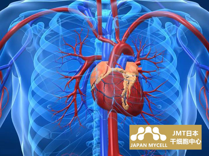 JMT日本干细胞中心-干细胞治疗心肌梗塞的临床试验结果