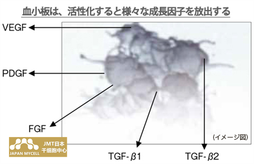 JMT日本干细胞中心-利用血小板的再生医疗因子治疗