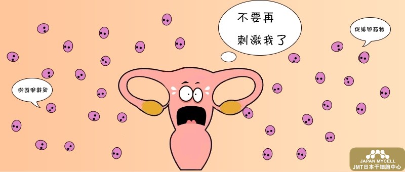 日本经血干细胞治疗卵巢-卵巢过度刺激综合症的原因、症状及治疗方法