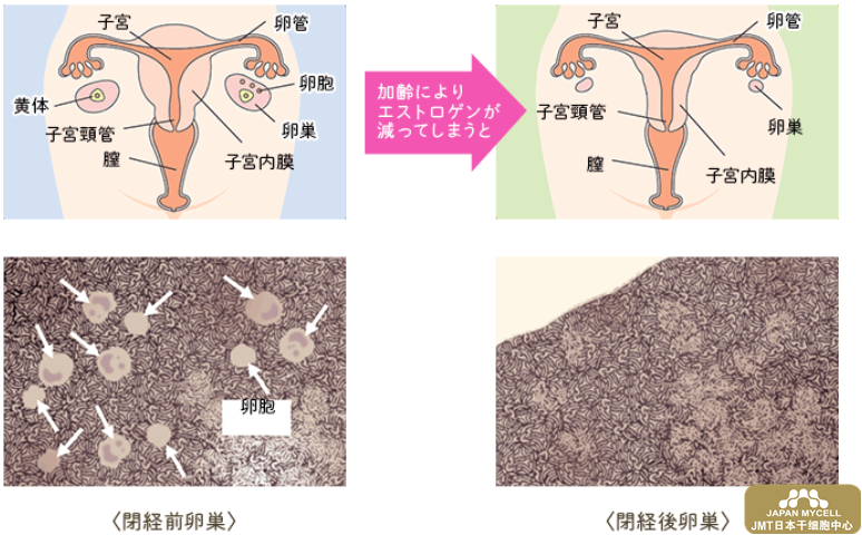 更年期身体的变化及日本经血干细胞改善更年期