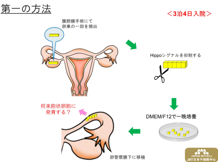 日本干细胞之高龄及卵子老化造成不孕不育的治疗②