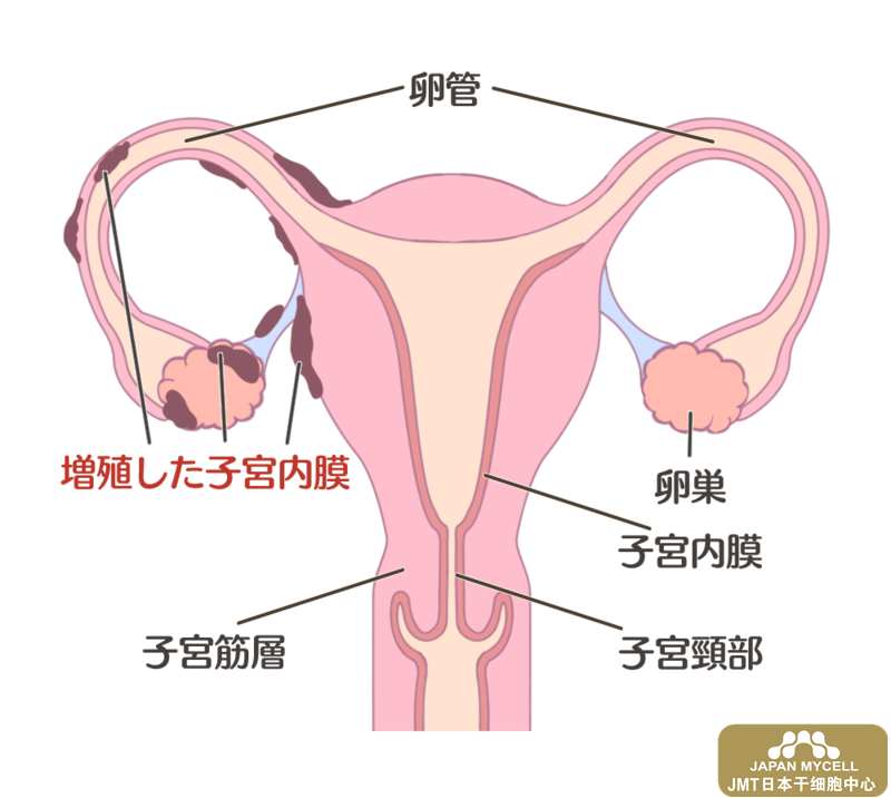 女性不孕不育的原因检查-日本干细胞治疗