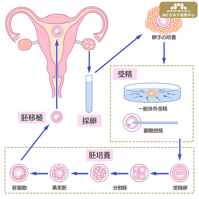 日本干细胞-体外受精的流程和治疗时间-干细胞有哪些帮助