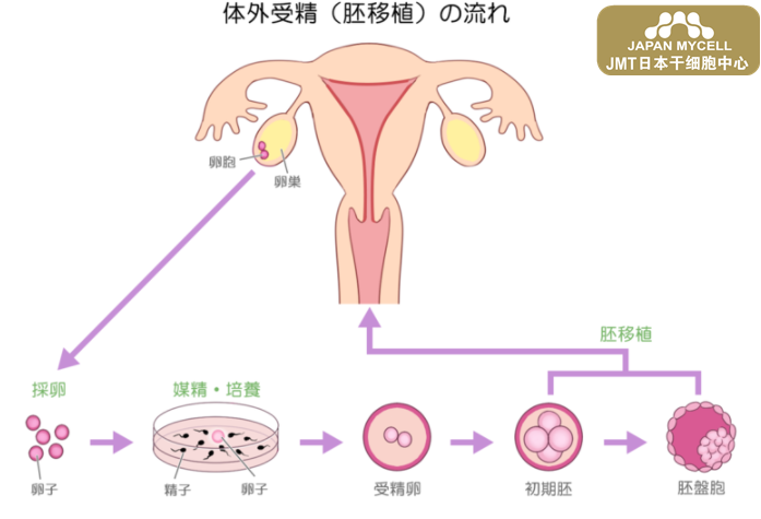 JMT日本干细胞-体外受精胚胎移植（IVF-ET）全解-日本干细胞如何治疗不孕不育①