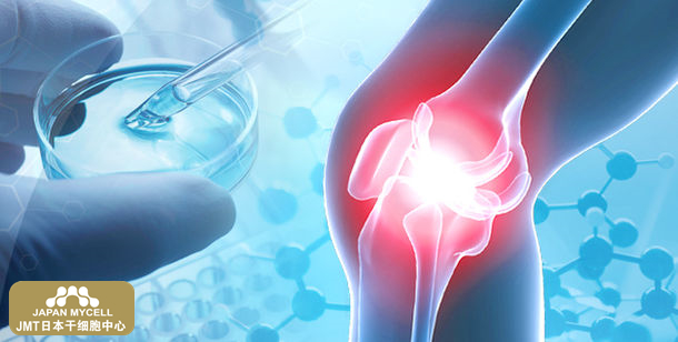 JMT日本干细胞中心-针对变形性膝关节症的再生医疗（自体脂肪由来间叶系干细胞治疗）（上）