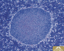 JMT日本干细胞中心介绍：使用iPS细胞的癌症疫苗防止胰腺癌肿瘤生长