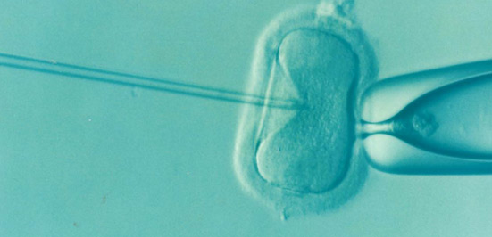成功从人类以及猴子的胎儿卵巢中体外培育出原始卵泡